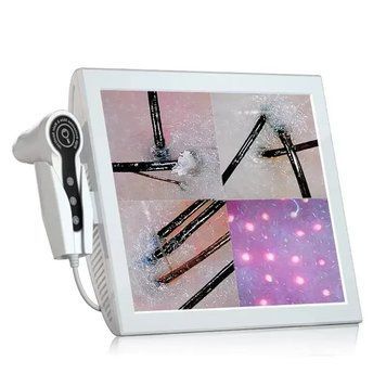 Трихоскоп Premium Plus 50x/200x з LCD-екраном 15 дюймів для діагностики шкіри голови та волосся